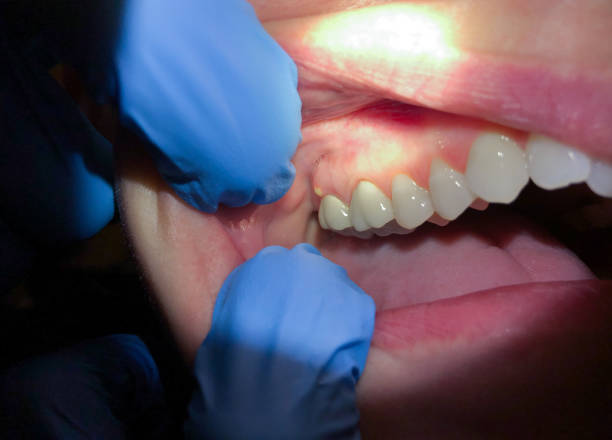 Best Weekend Emergency Dentist in Somerville, TX