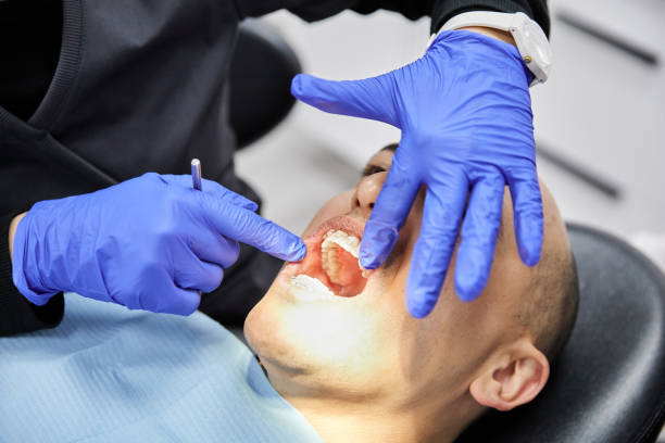 Best Emergency Dental Services for Seniors in Somerville, TX