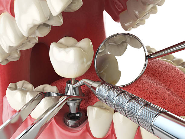 Best Mobile Emergency Dentist in Somerville, TX