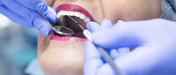 Best Emergency Dental Extractions in Somerville, TX